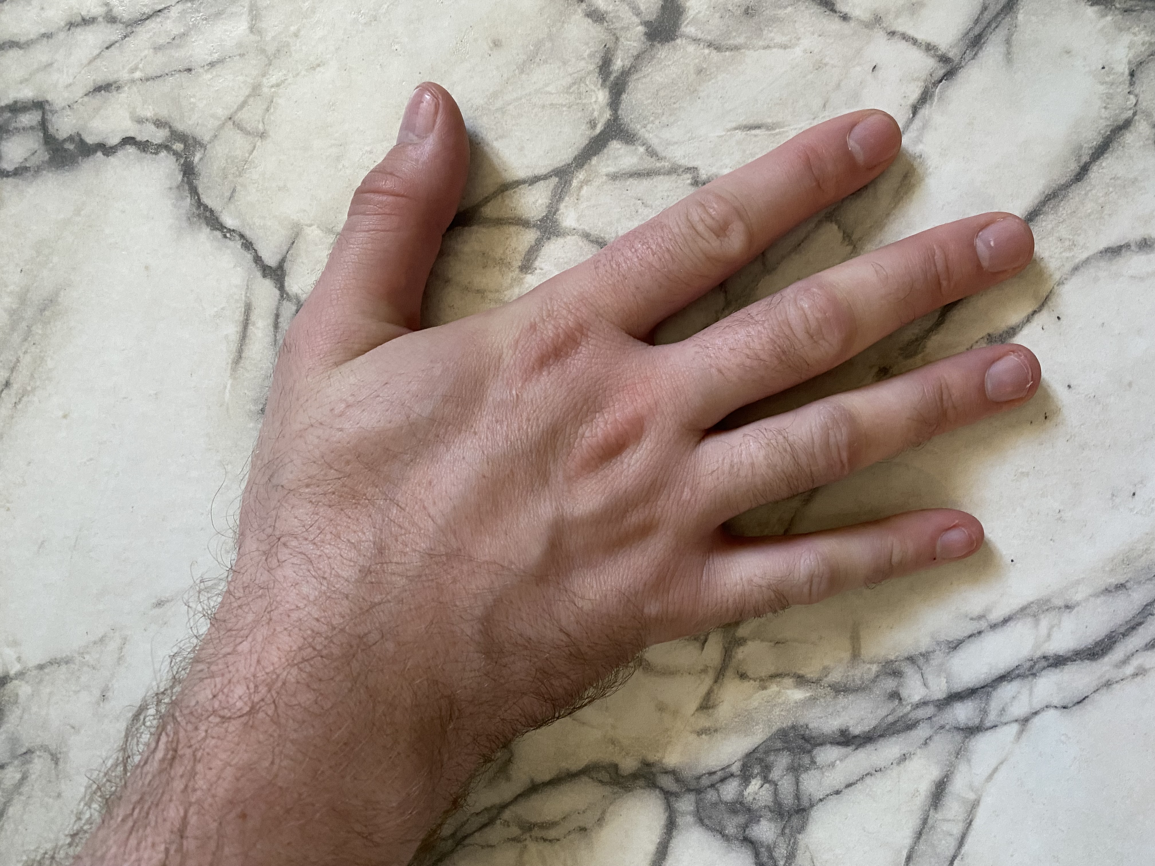 Close up of back of a man's left hand