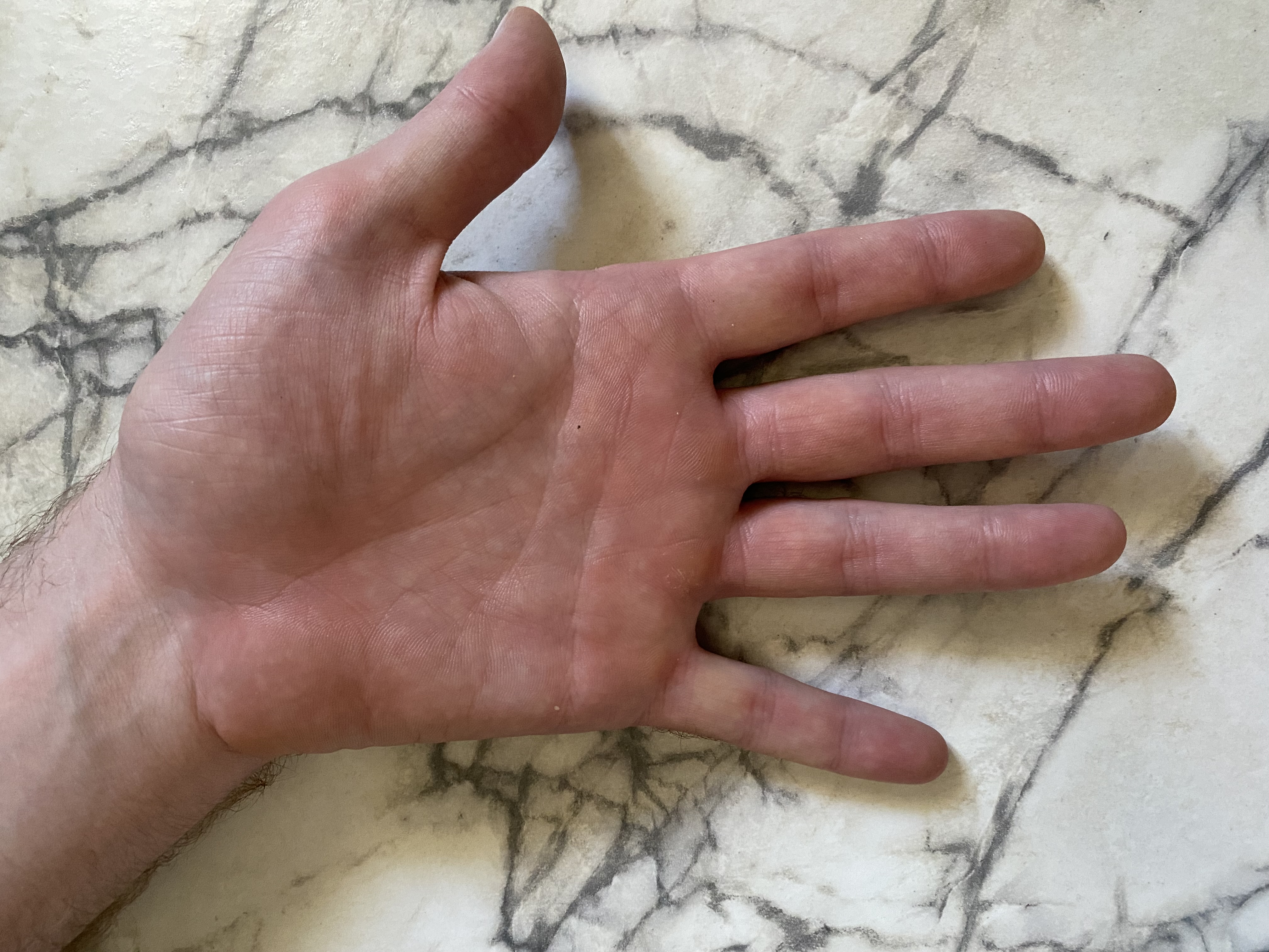 A close up of a man's left palm