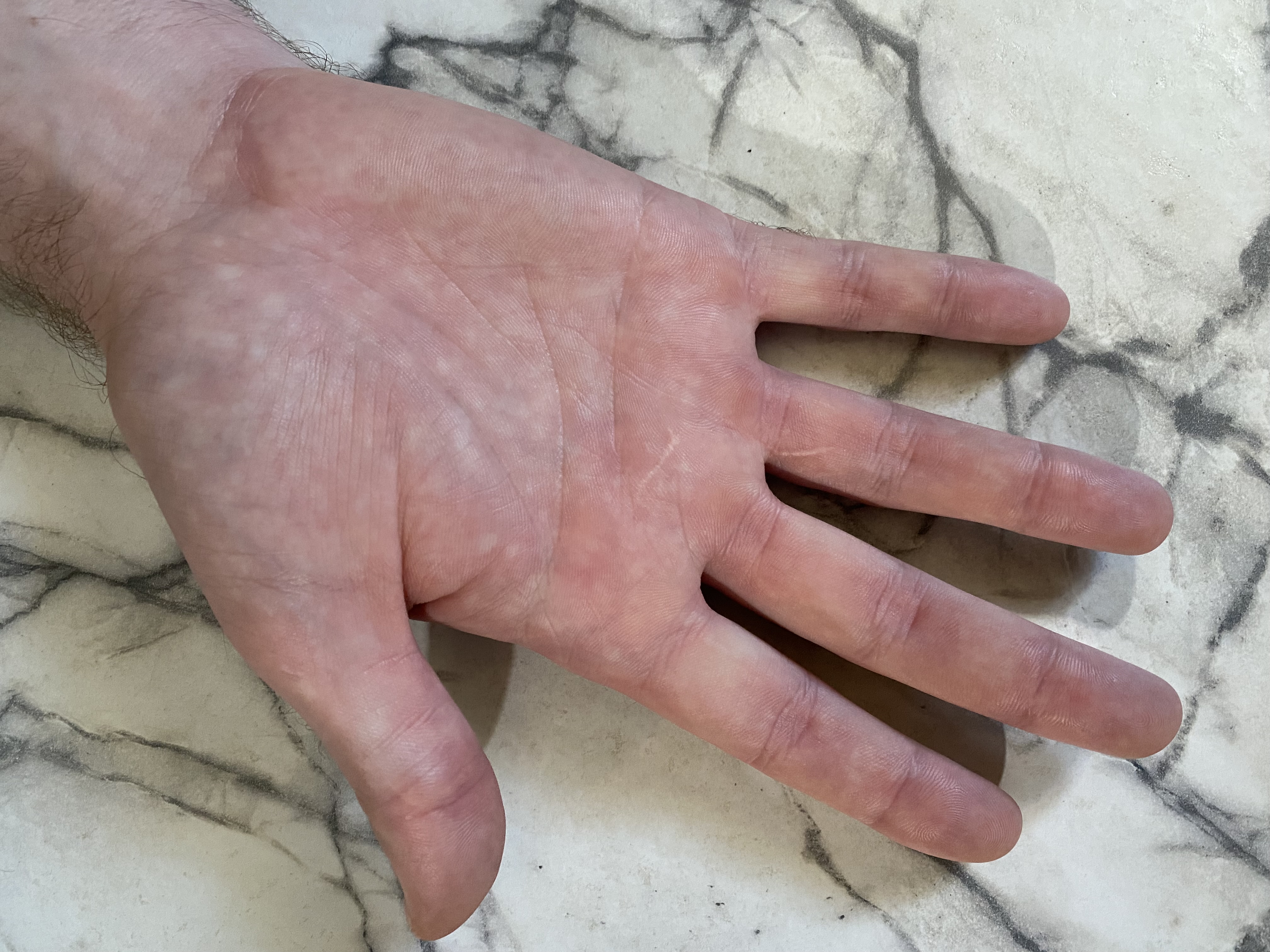 A close up of a man's right palm
